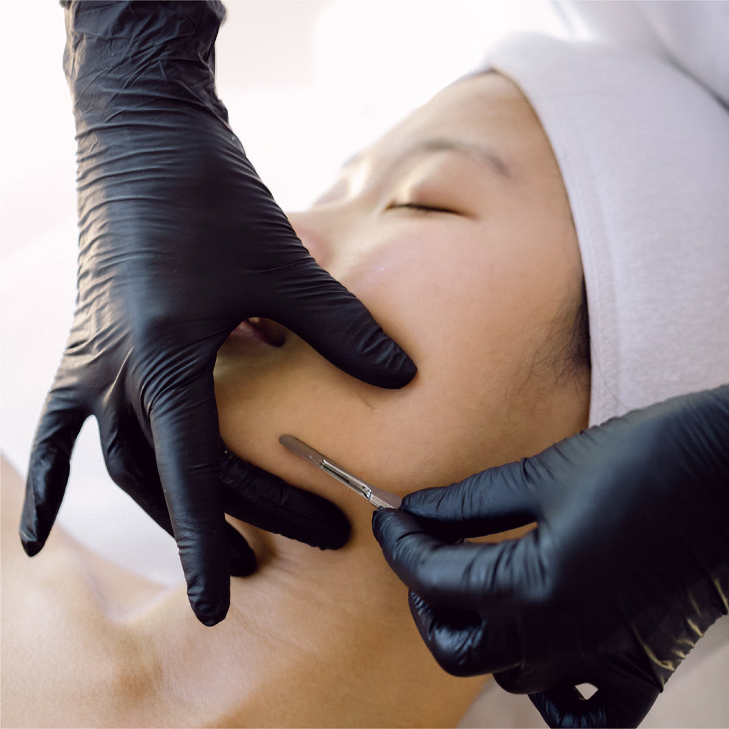 Dermaplaning - Vancouver, BC